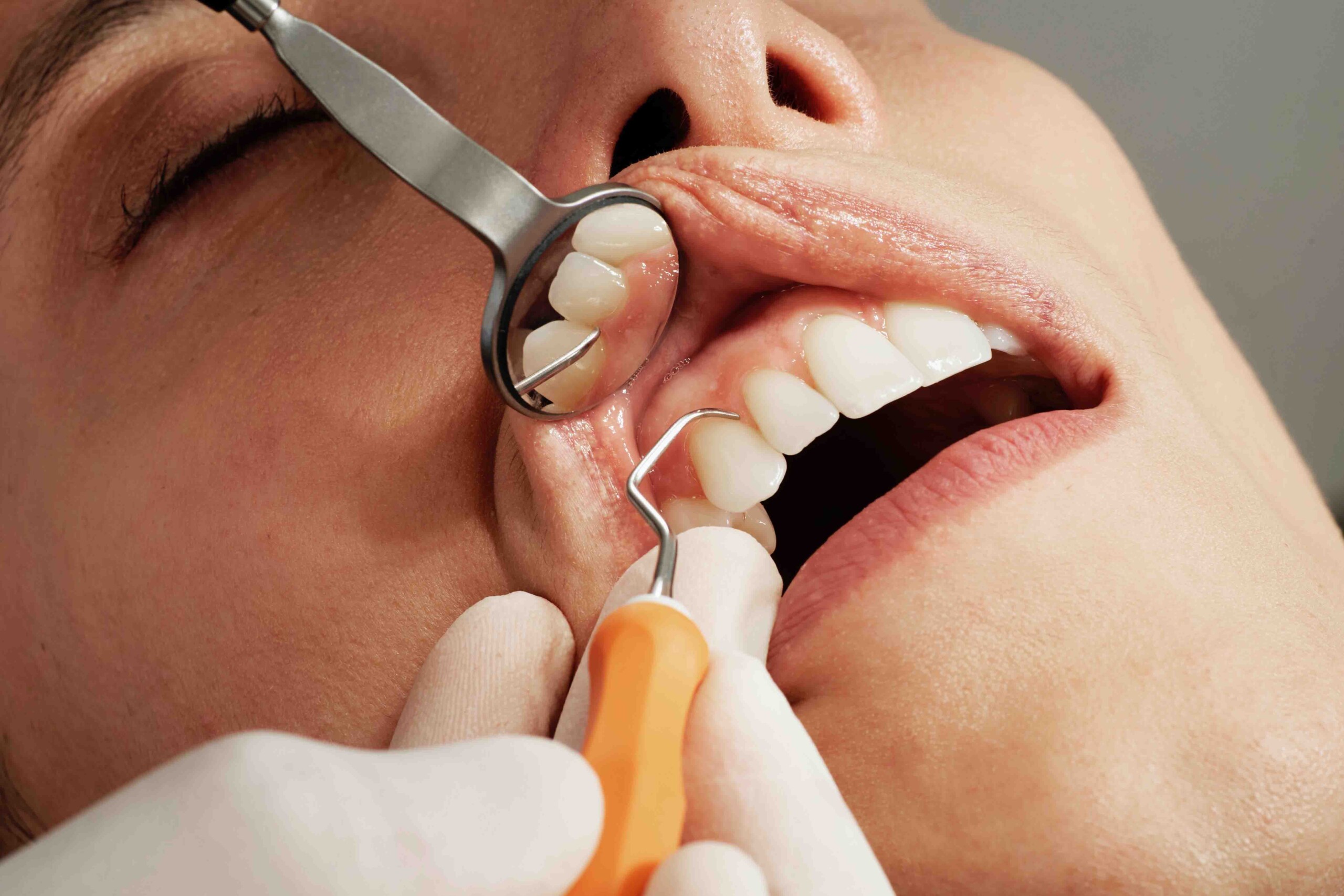cosmetic dentist in Taree